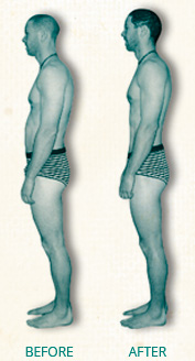 Posture before and after.